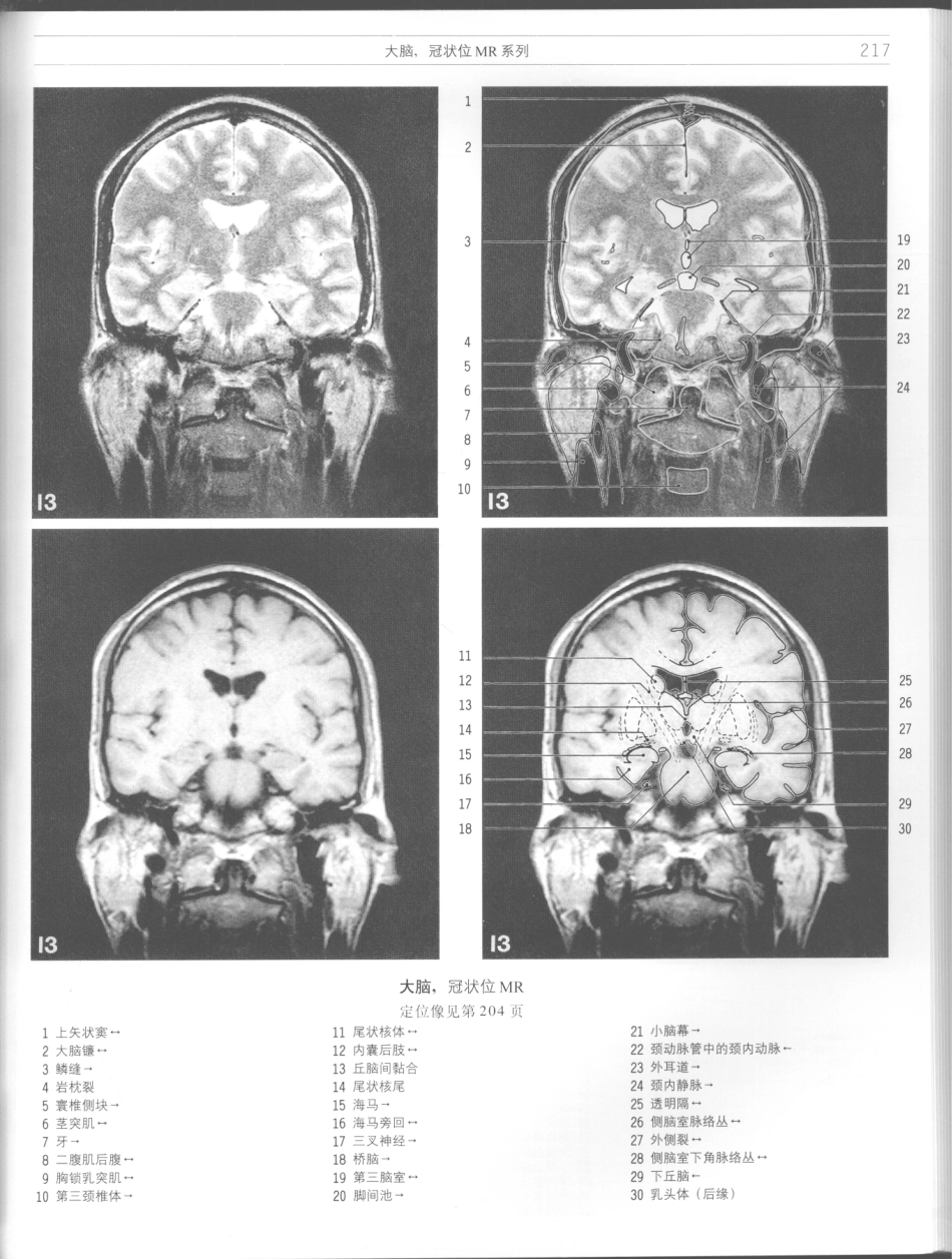 影像解剖学_11724881_217-228.pdf_第3页