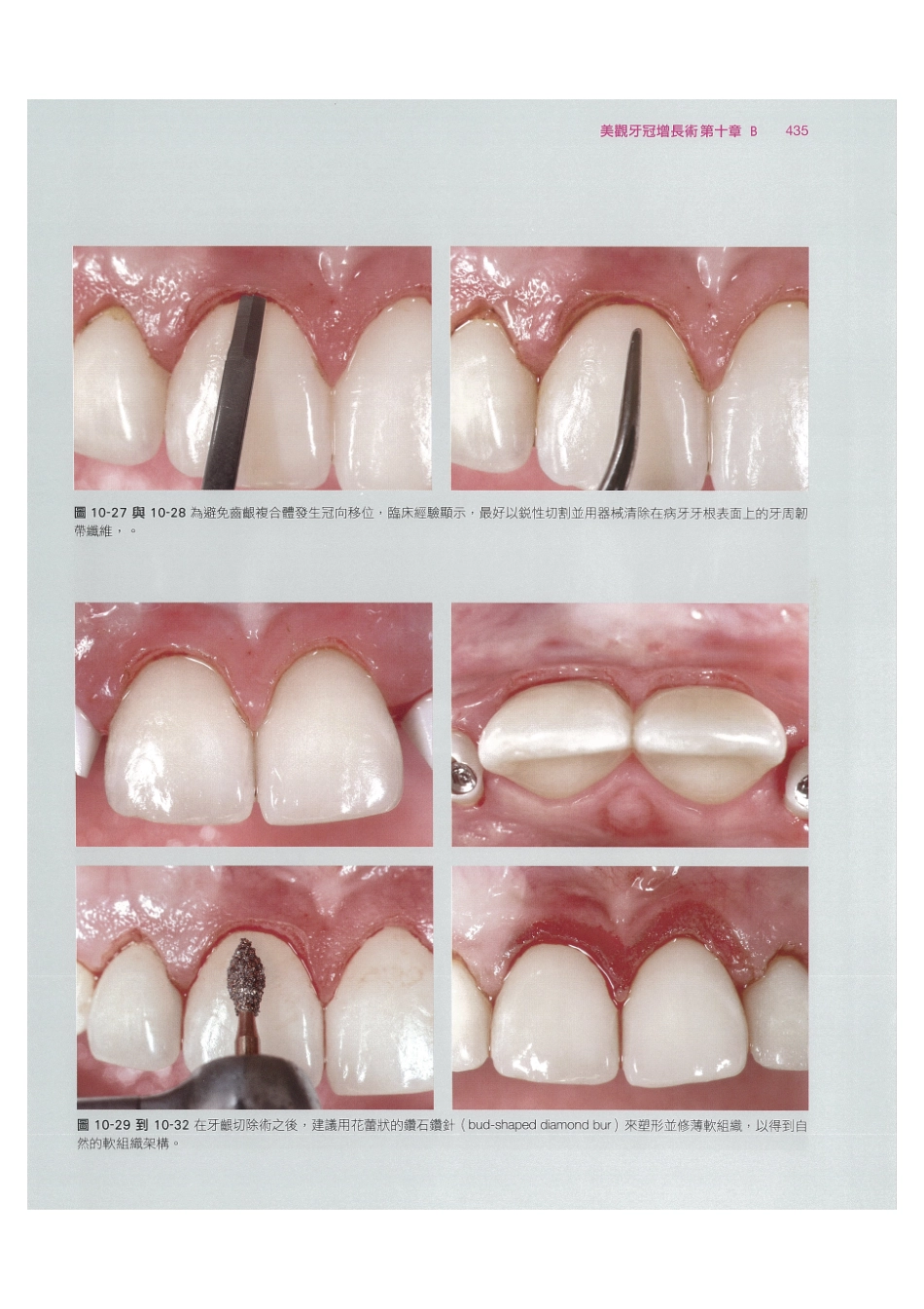 179.牙周整形美容与种植手术_449-456.pdf_第1页