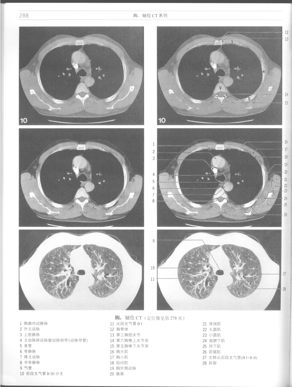 影像解剖学_11724881_289-300.pdf_第2页