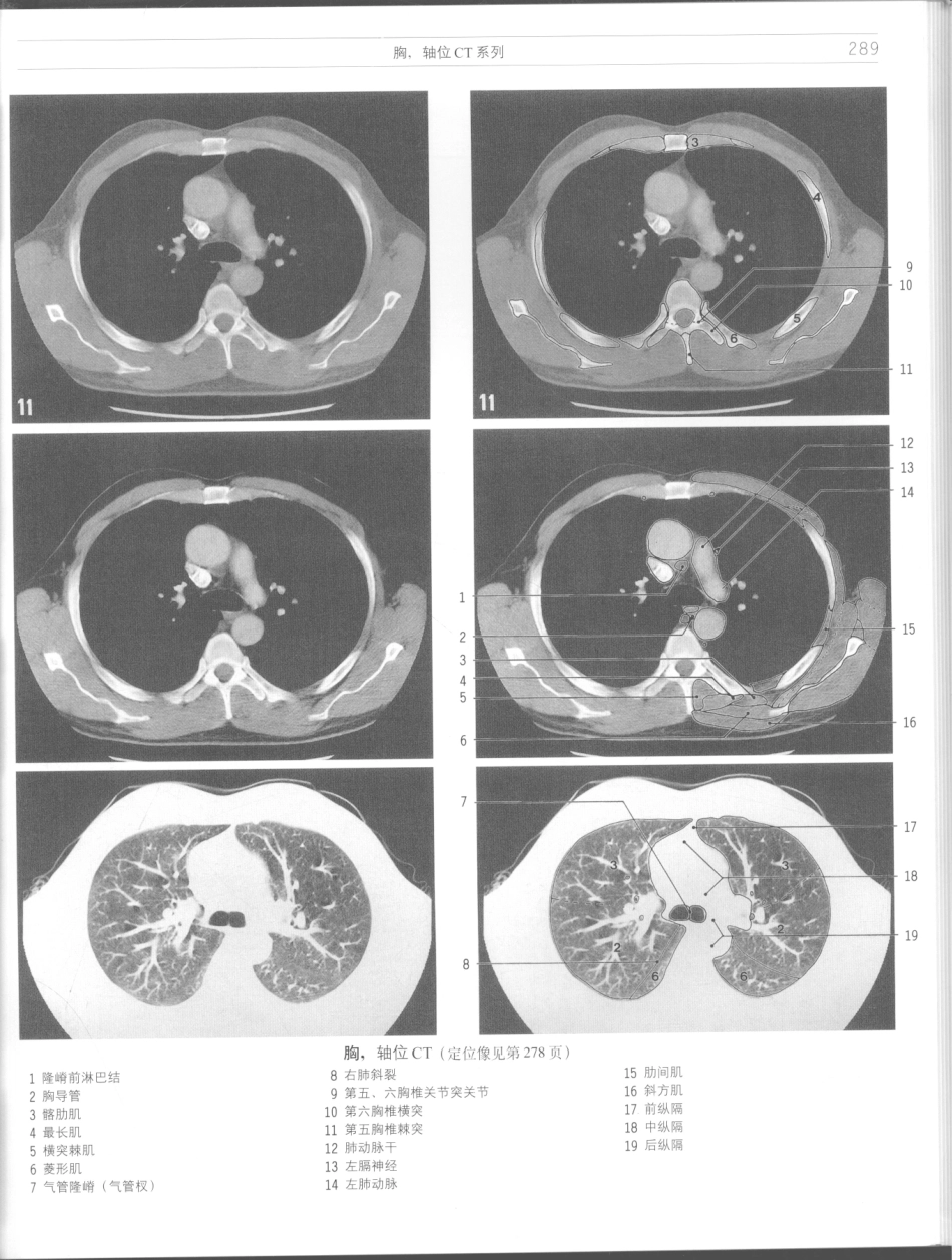 影像解剖学_11724881_289-300.pdf_第3页