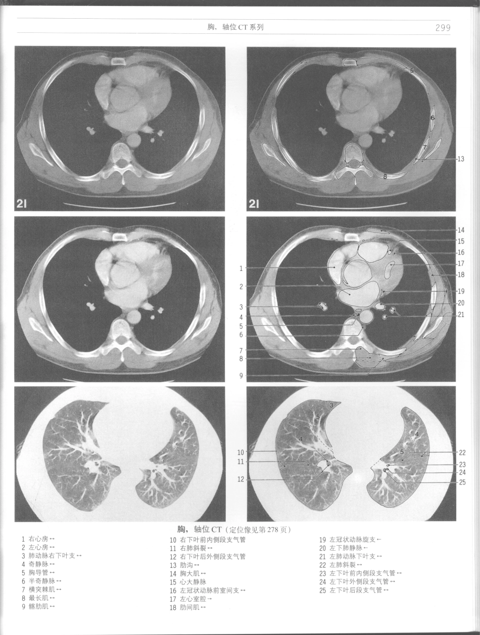 影像解剖学_11724881_301-312.pdf_第1页