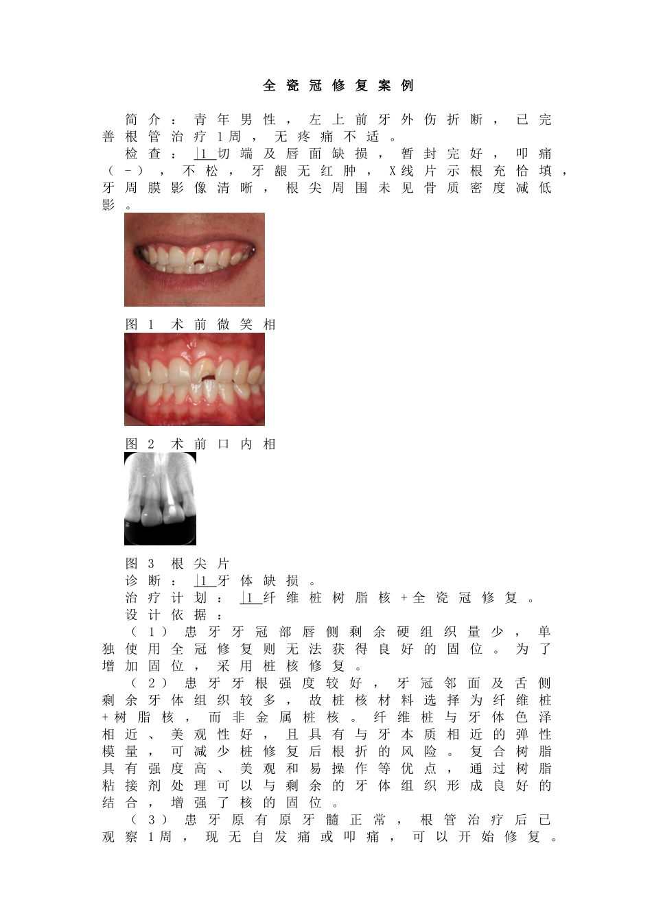 全瓷冠修复案例.doc_第1页