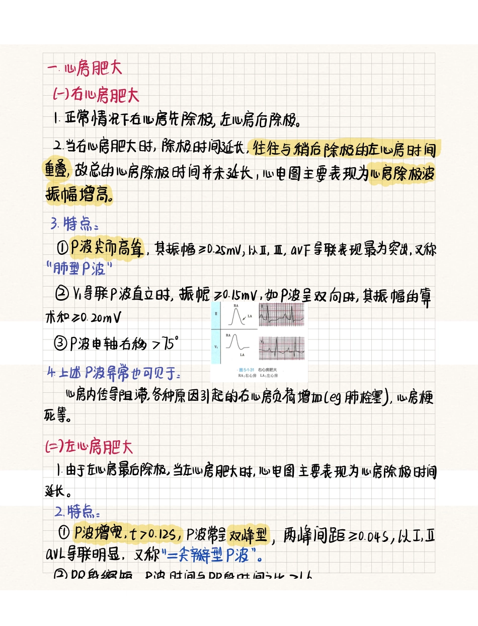 医学科目：心电图心脏肥大与心肌缺血.pdf_第1页