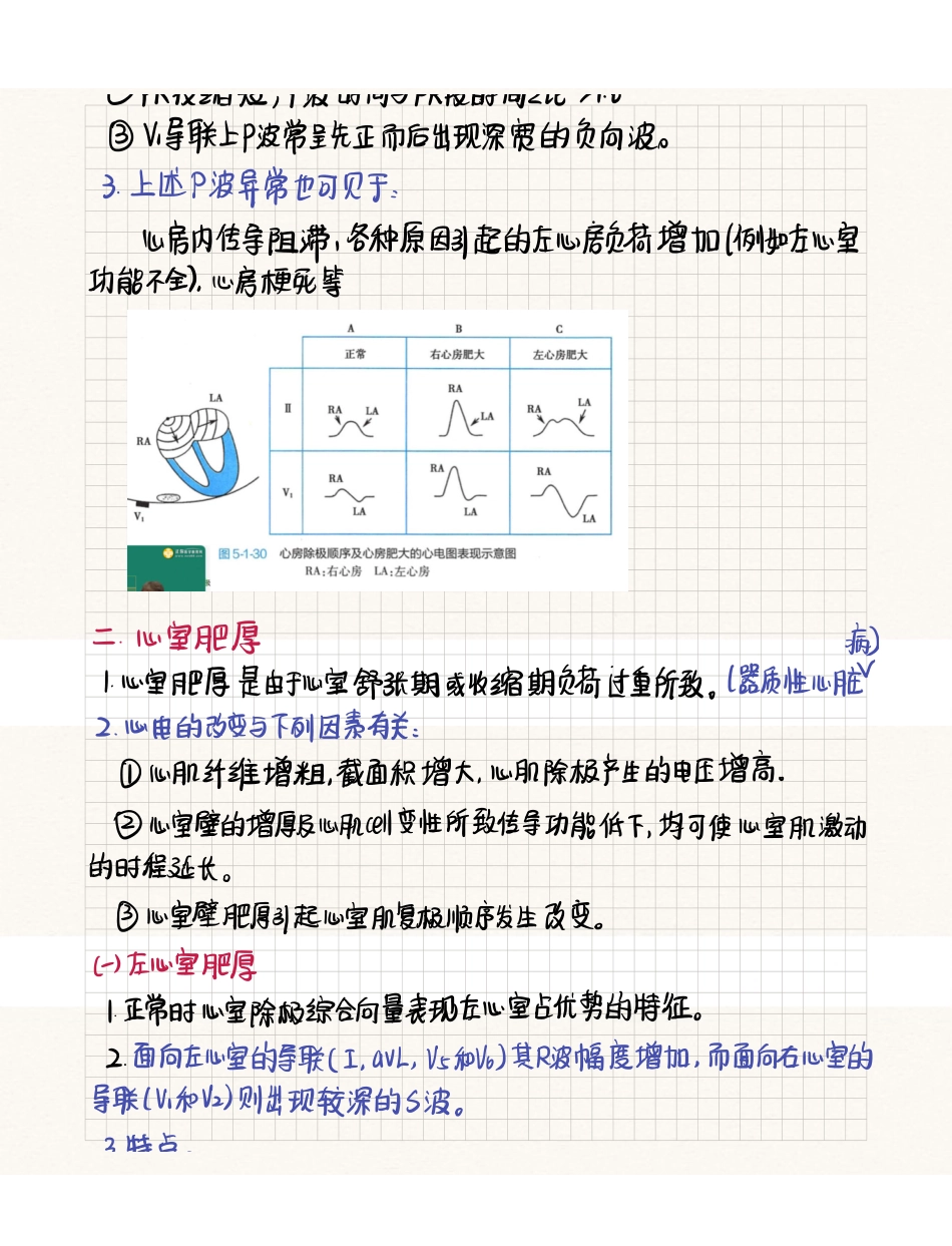 医学科目：心电图心脏肥大与心肌缺血.pdf_第2页