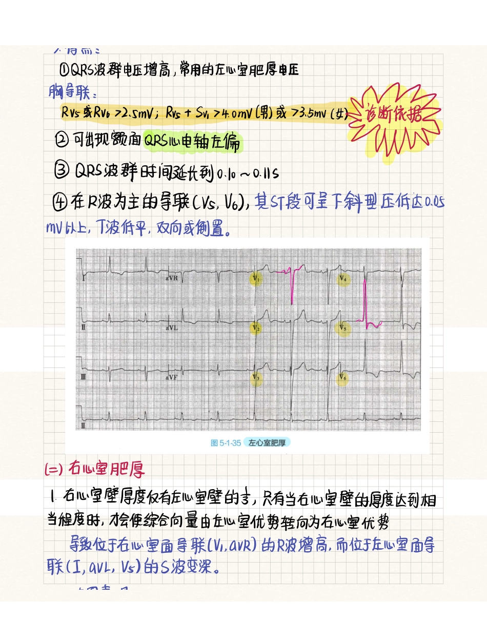 医学科目：心电图心脏肥大与心肌缺血.pdf_第3页