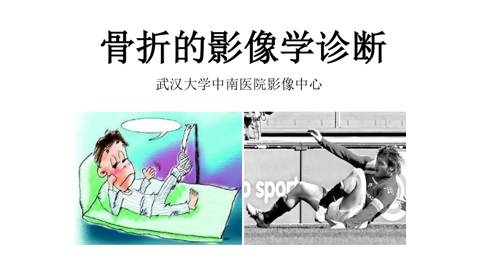 医学学科：(2.1.1)--骨折的影像学诊断.pdf_第1页