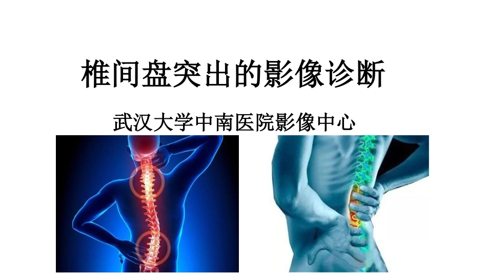 医学学科：(2.2.1)--椎间盘突出的影像学诊断.pdf_第1页