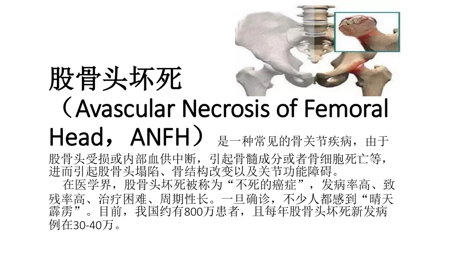 医学学科：(2.3.1)--股骨头坏死的影像学诊断.pdf_第3页