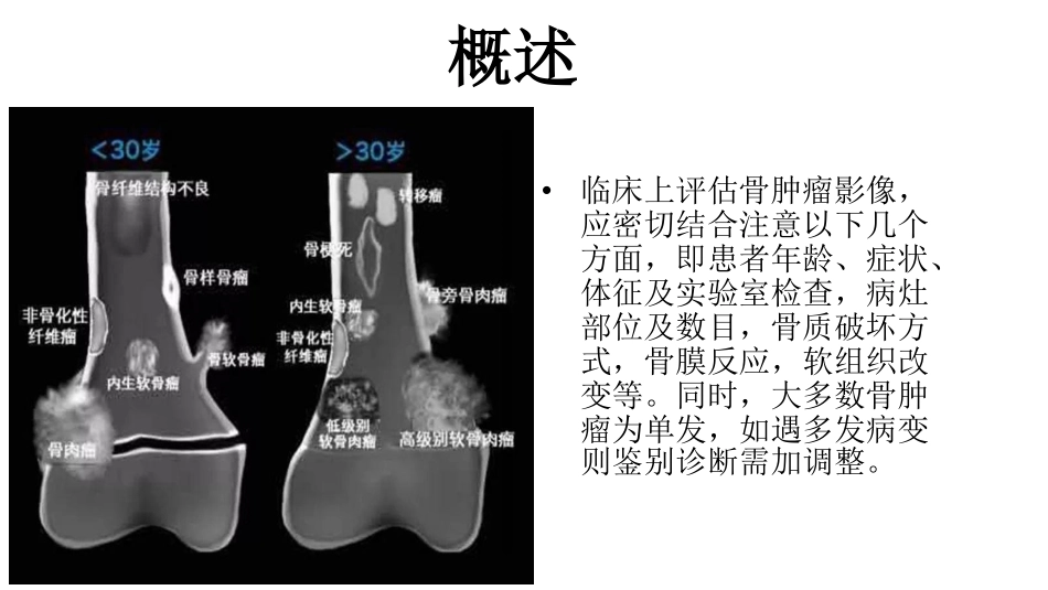医学学科：(2.4.1)--骨肿瘤的影像学诊断.pdf_第2页