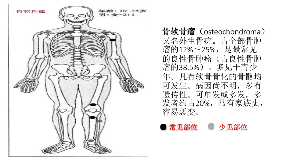 医学学科：(2.4.1)--骨肿瘤的影像学诊断.pdf_第3页