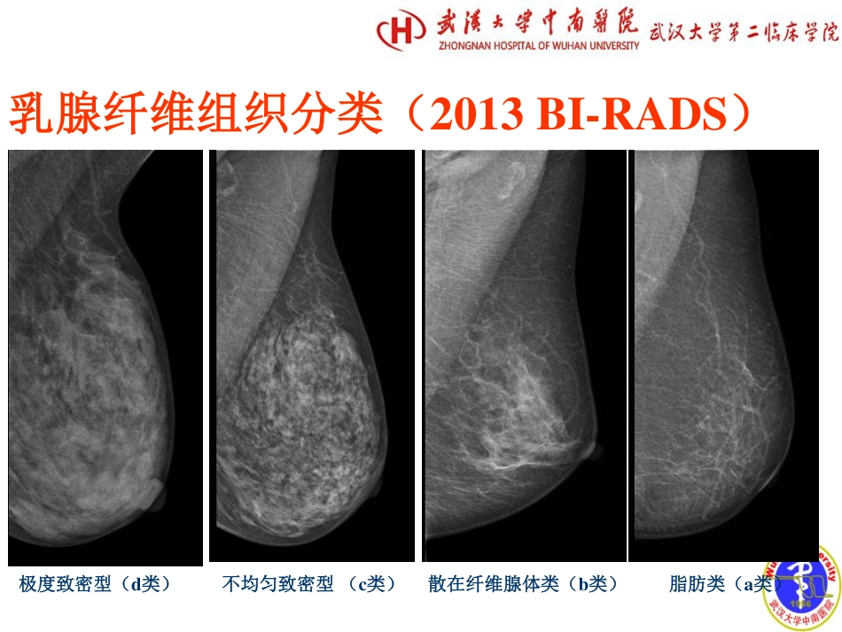 医学学科：(7.3.1)--乳腺癌影像学诊断.pdf_第3页