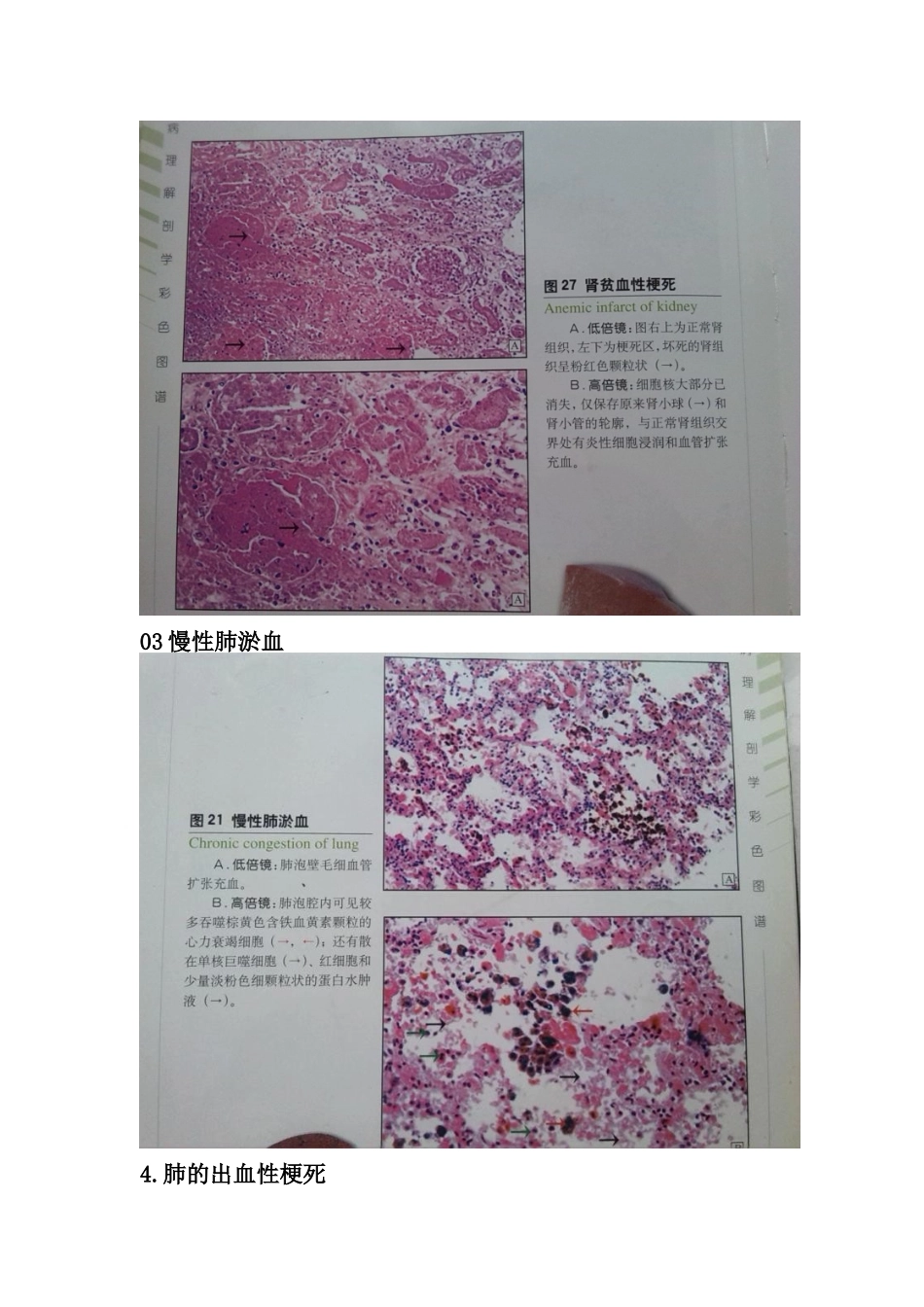 医学学科：切片标本1.doc_第2页