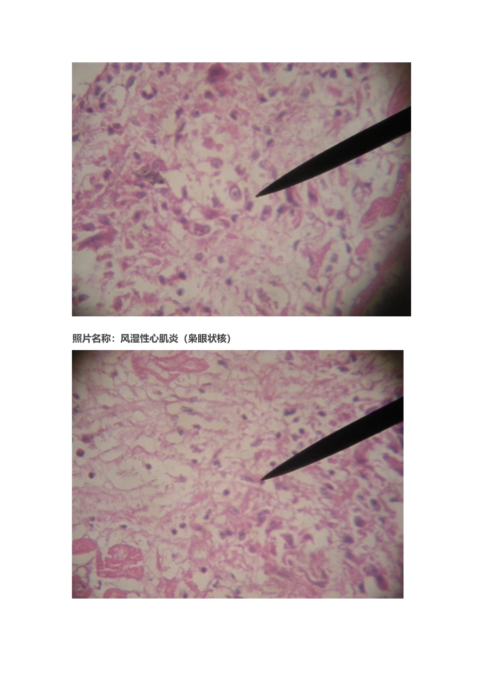 医学学科：切片标本2.doc_第1页