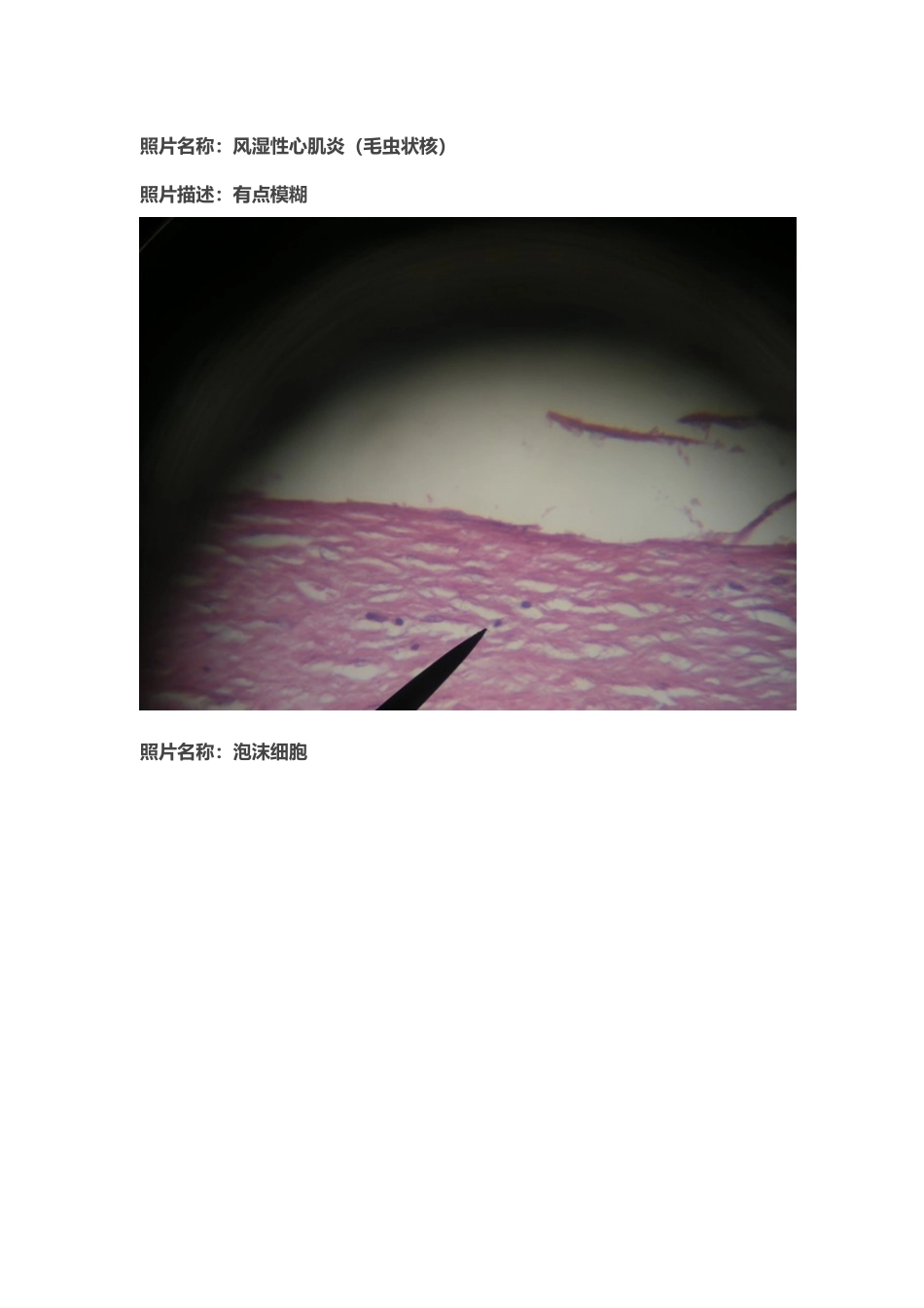医学学科：切片标本2.doc_第2页