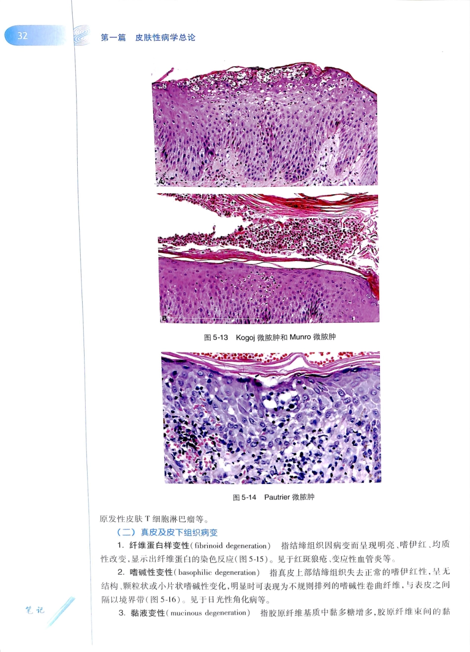 29.皮肤性病学(第8版)_49-60.pdf_第3页