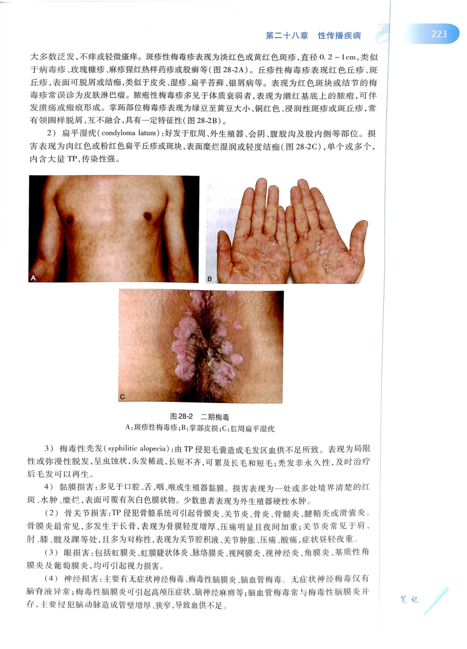 29.皮肤性病学(第8版)_241-252.pdf_第2页