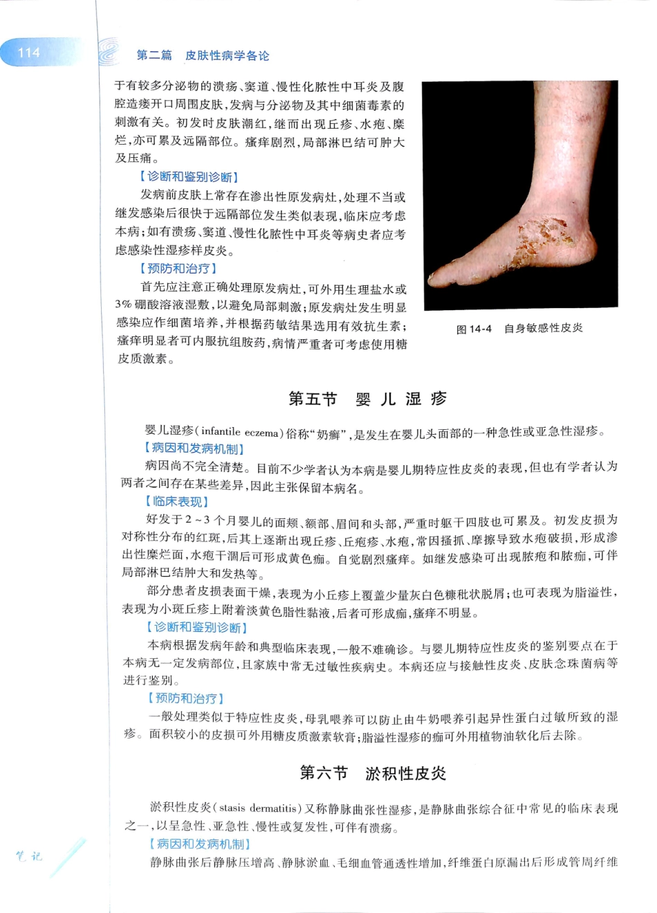 29.皮肤性病学(第8版)_133-144.pdf_第1页