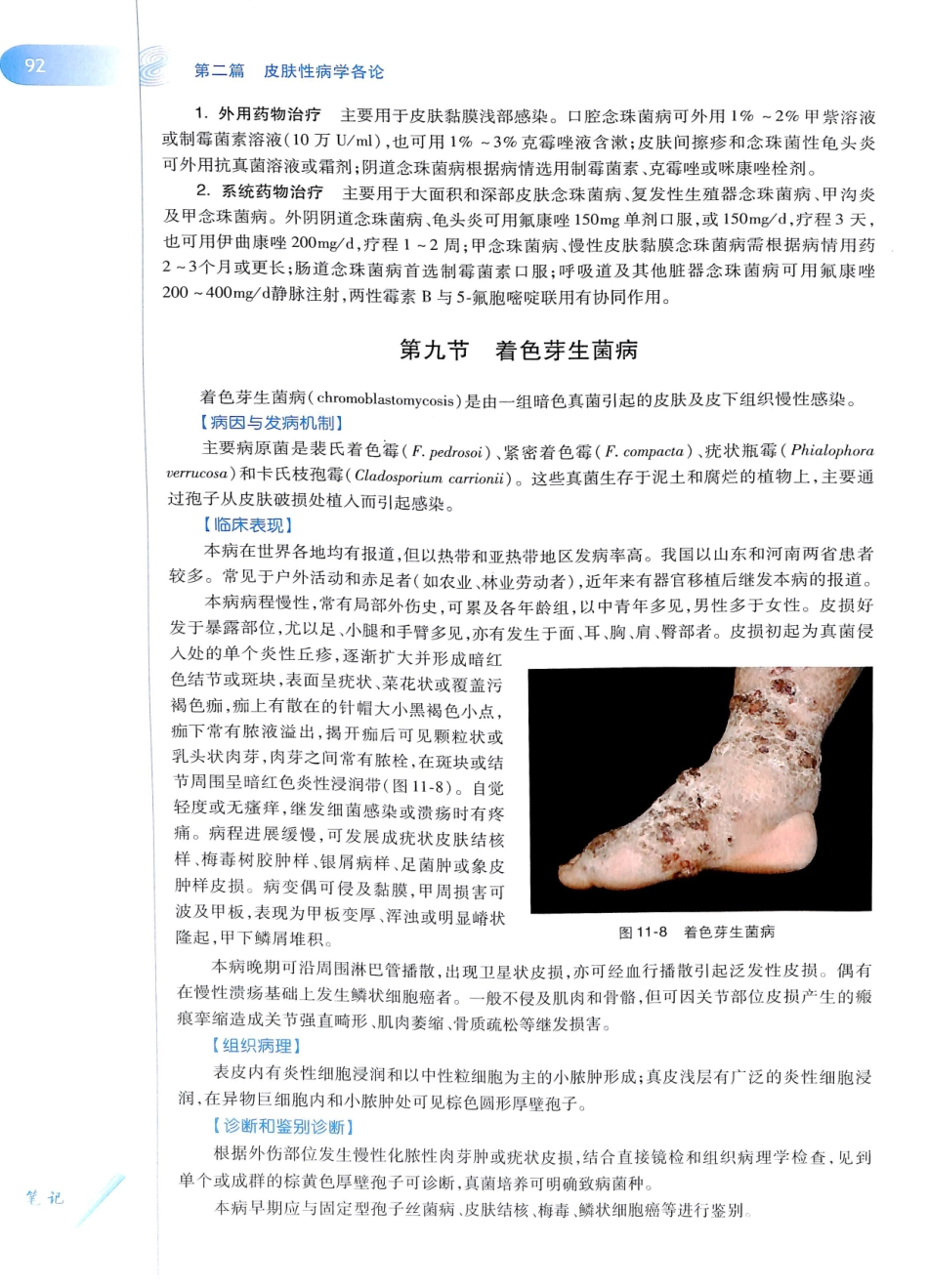 29.皮肤性病学(第8版)_109-120.pdf_第3页