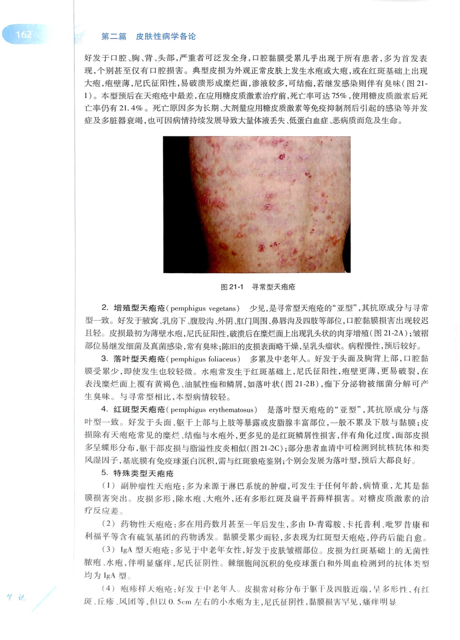 29.皮肤性病学(第8版)_181-192.pdf_第1页