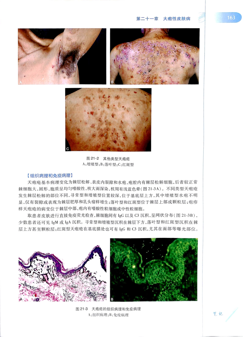 29.皮肤性病学(第8版)_181-192.pdf_第2页