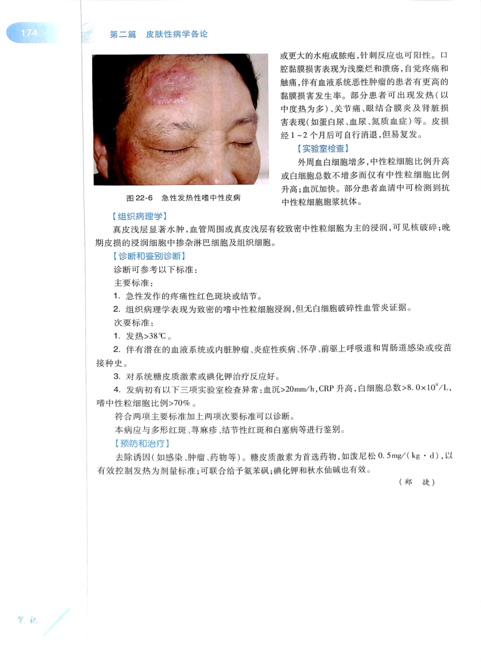 29.皮肤性病学(第8版)_193-204.pdf_第1页