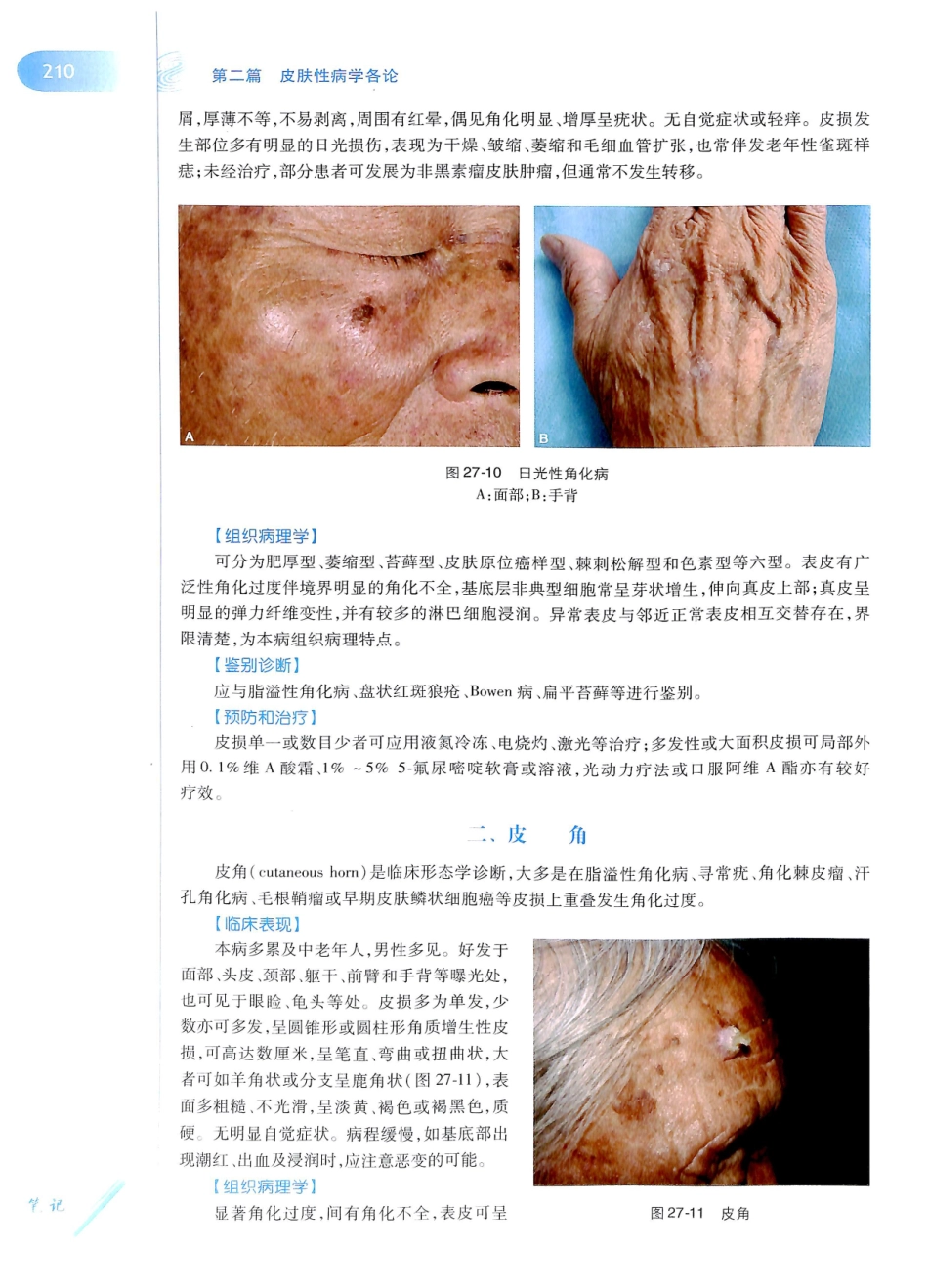 29.皮肤性病学(第8版)_229-240.pdf_第1页