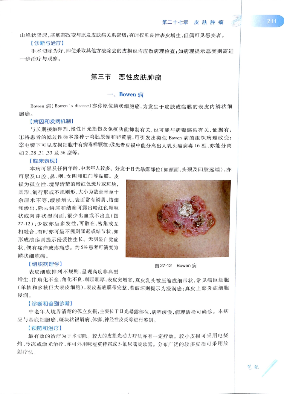 29.皮肤性病学(第8版)_229-240.pdf_第2页