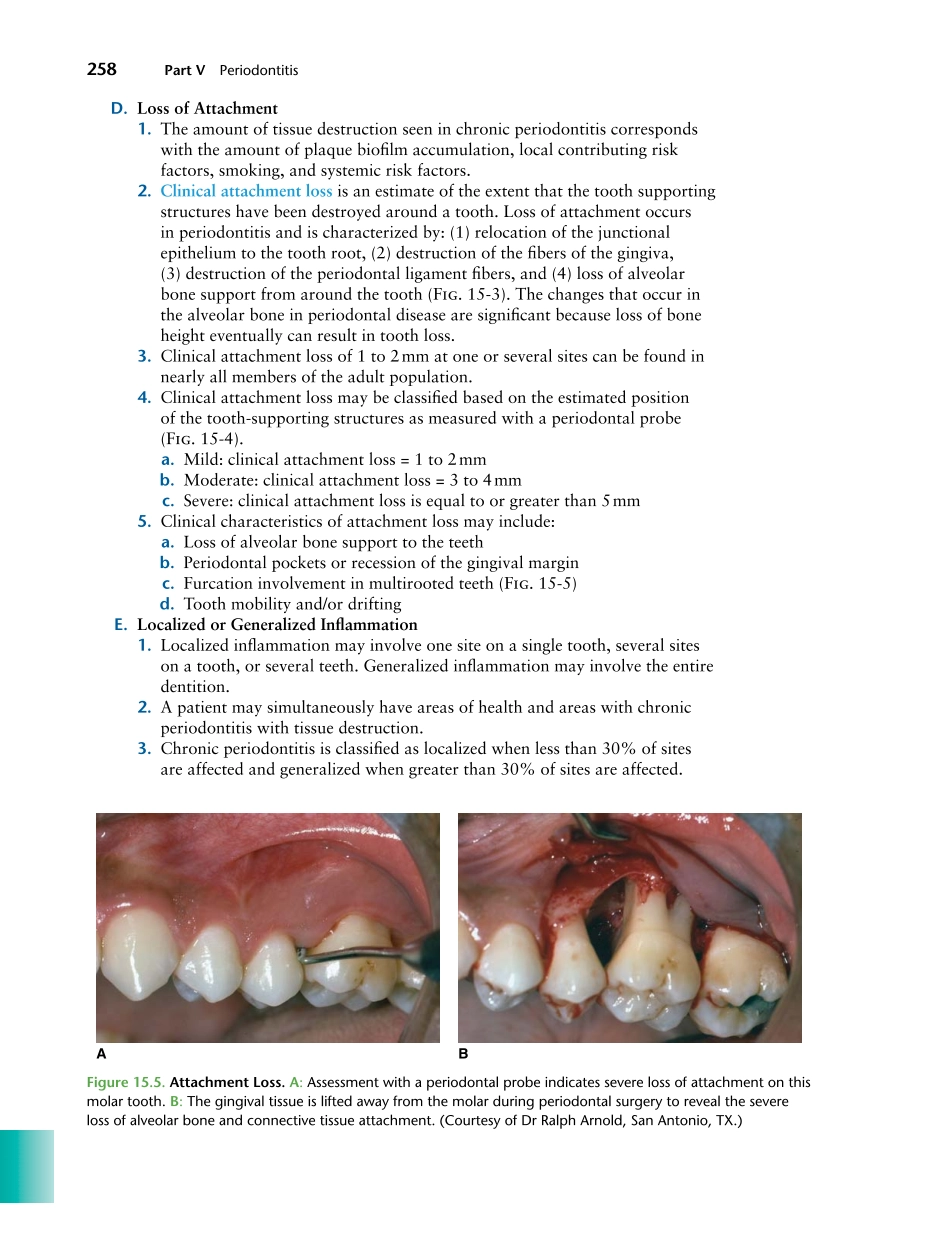 牙周2012Foundations of Periodontics for the Dental Hygienist _276-300.pdf_第1页