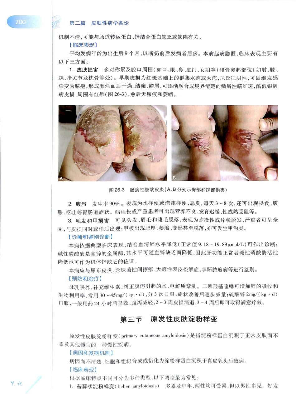 29.皮肤性病学(第8版)_217-228.pdf_第3页