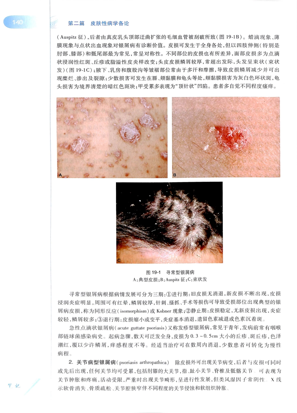 29.皮肤性病学(第8版)_157-168.pdf_第3页