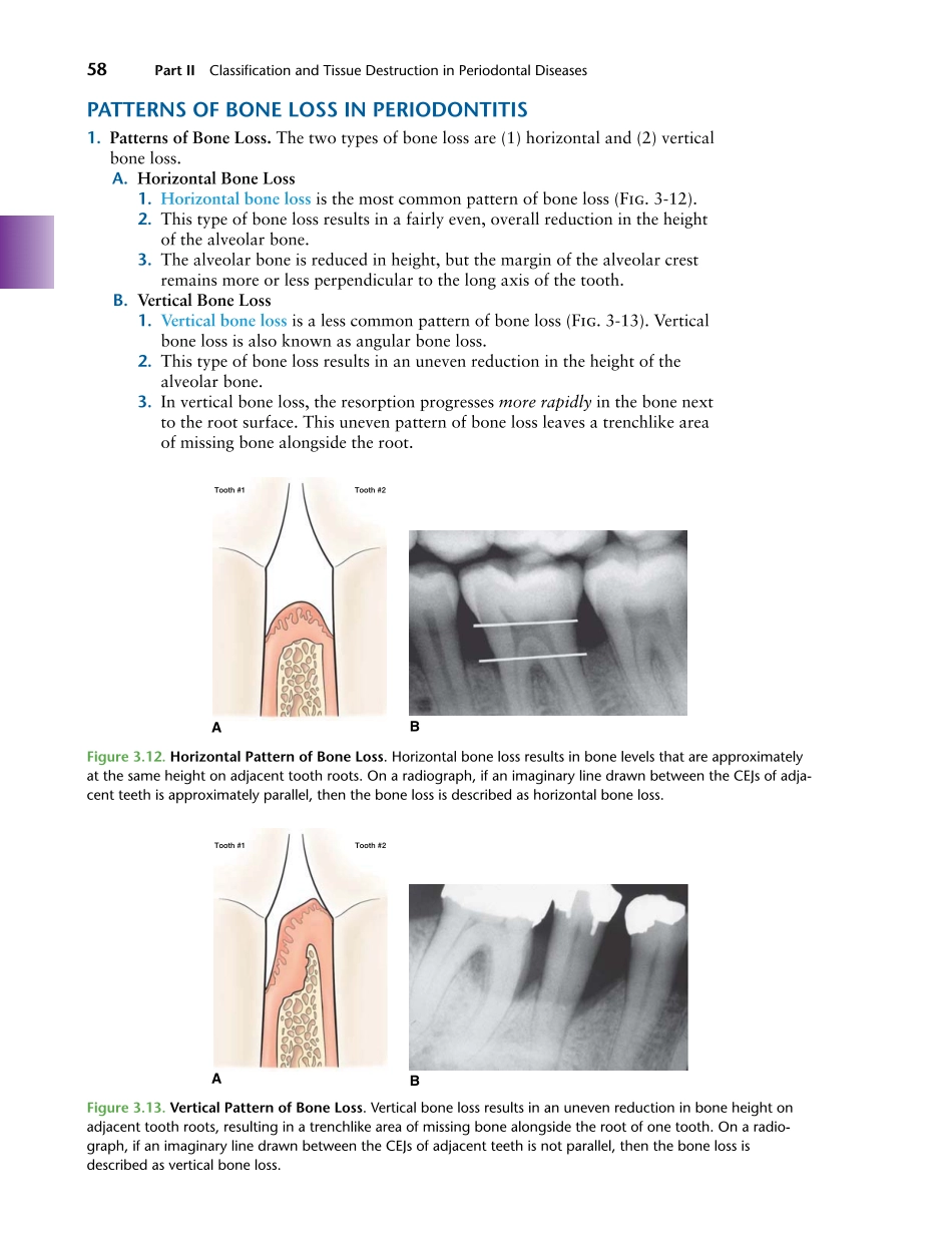 牙周2012Foundations of Periodontics for the Dental Hygienist _76-100.pdf_第1页