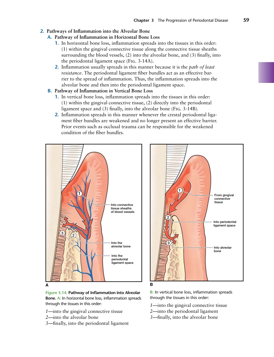 牙周2012Foundations of Periodontics for the Dental Hygienist _76-100.pdf_第2页