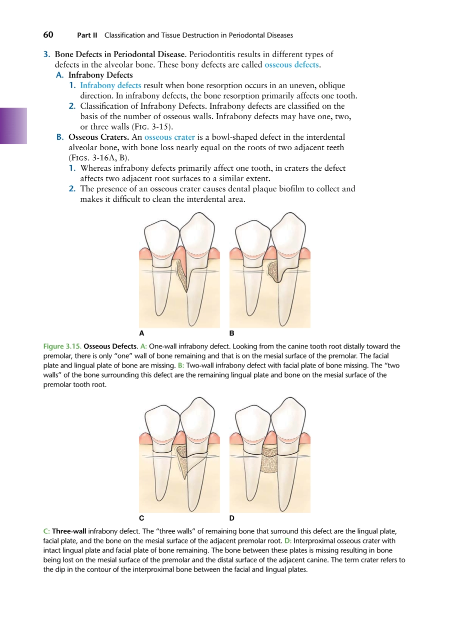 牙周2012Foundations of Periodontics for the Dental Hygienist _76-100.pdf_第3页