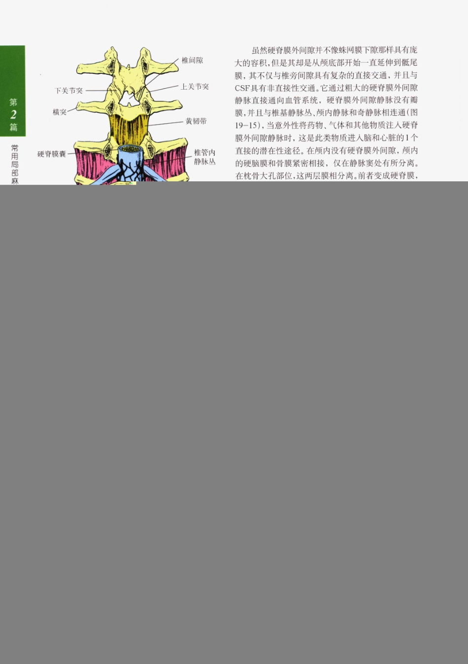 临床局部麻醉技术_301-325.pdf_第3页