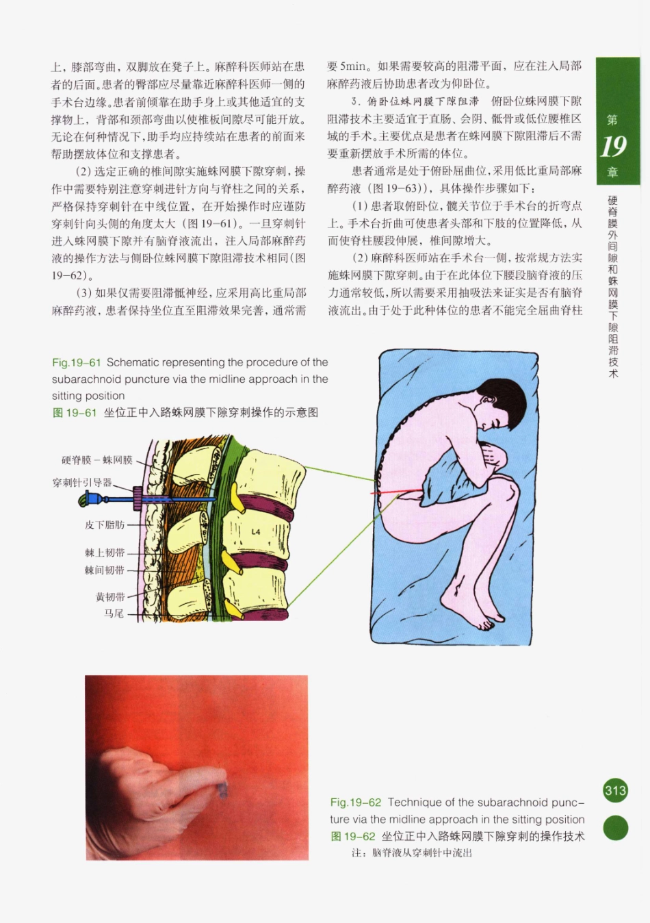 临床局部麻醉技术_326-350.pdf_第3页