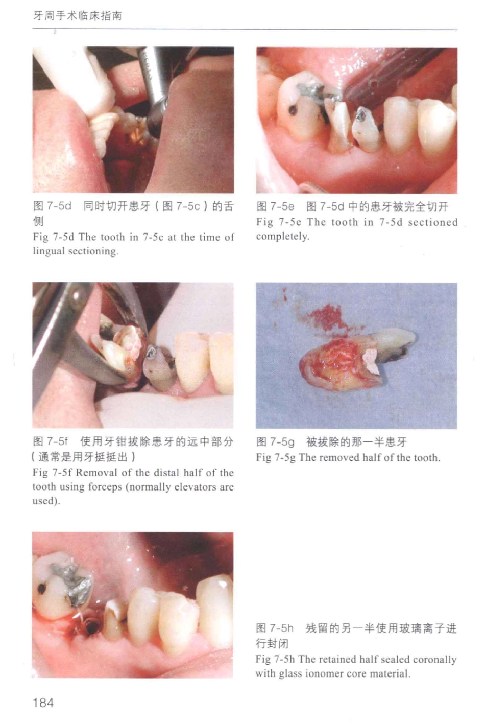 牙周手术临床指南 中英文对照_俞雪芬2013（彩图）_193-204.pdf_第2页