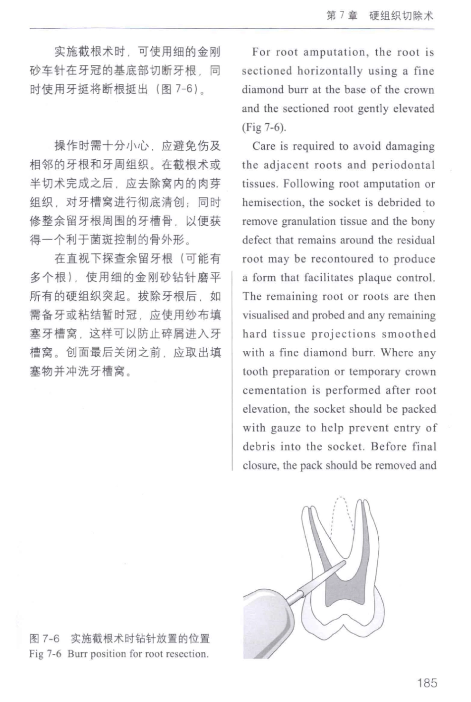 牙周手术临床指南 中英文对照_俞雪芬2013（彩图）_193-204.pdf_第3页