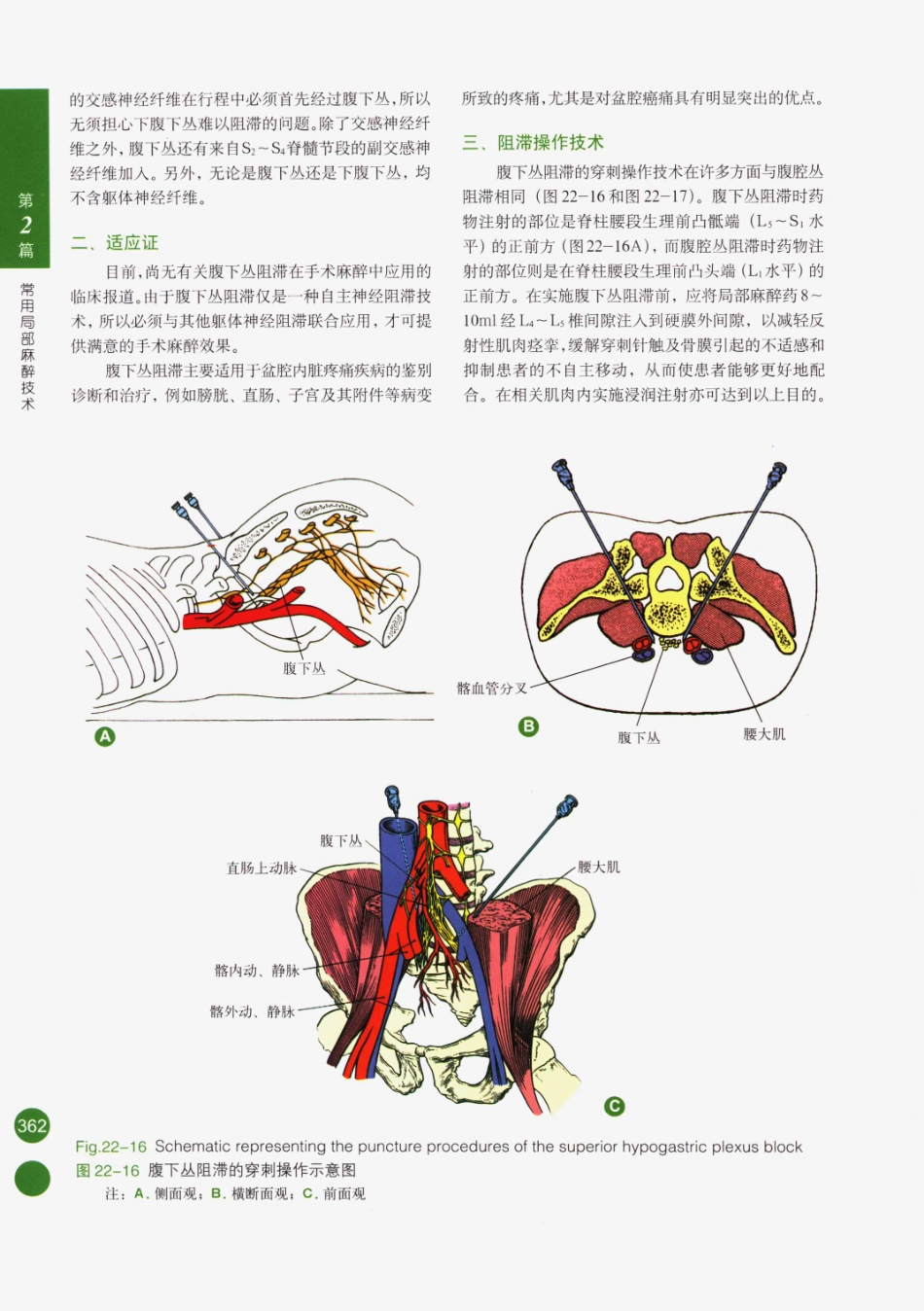 临床局部麻醉技术_376-400.pdf_第2页
