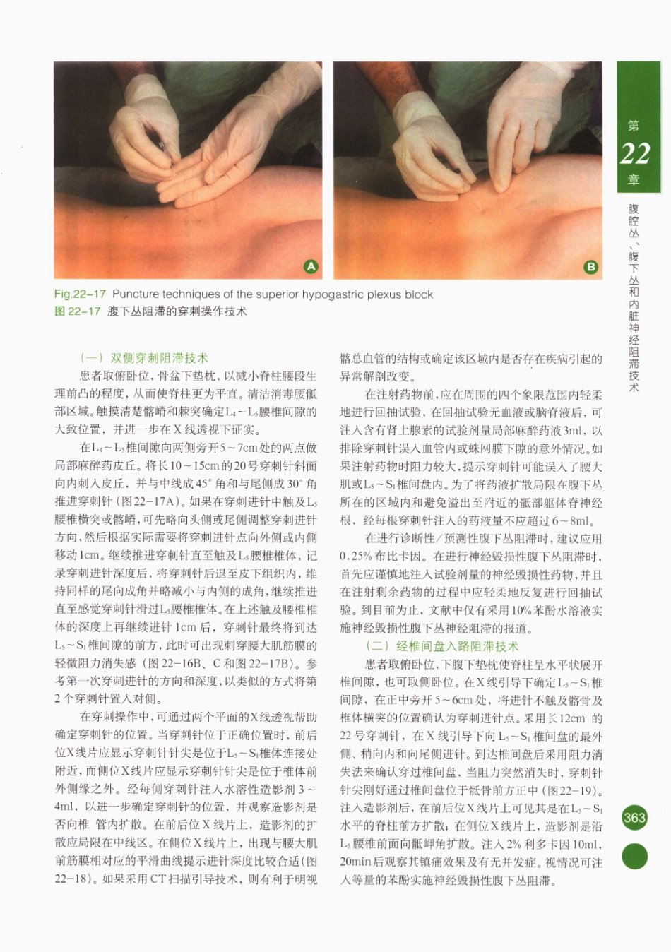 临床局部麻醉技术_376-400.pdf_第3页