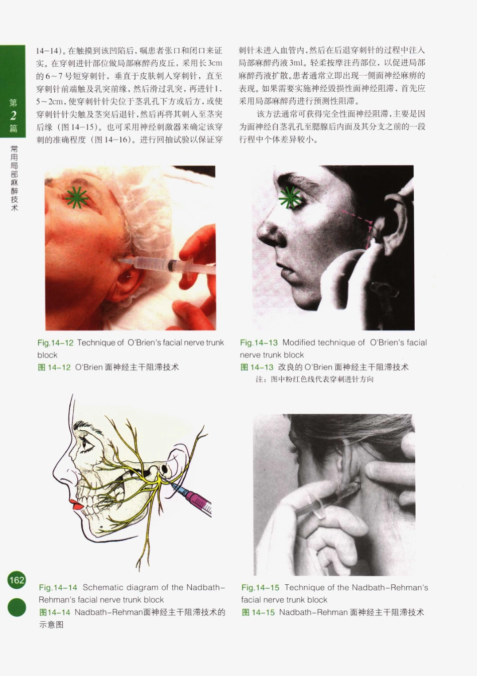 临床局部麻醉技术_176-200.pdf_第2页