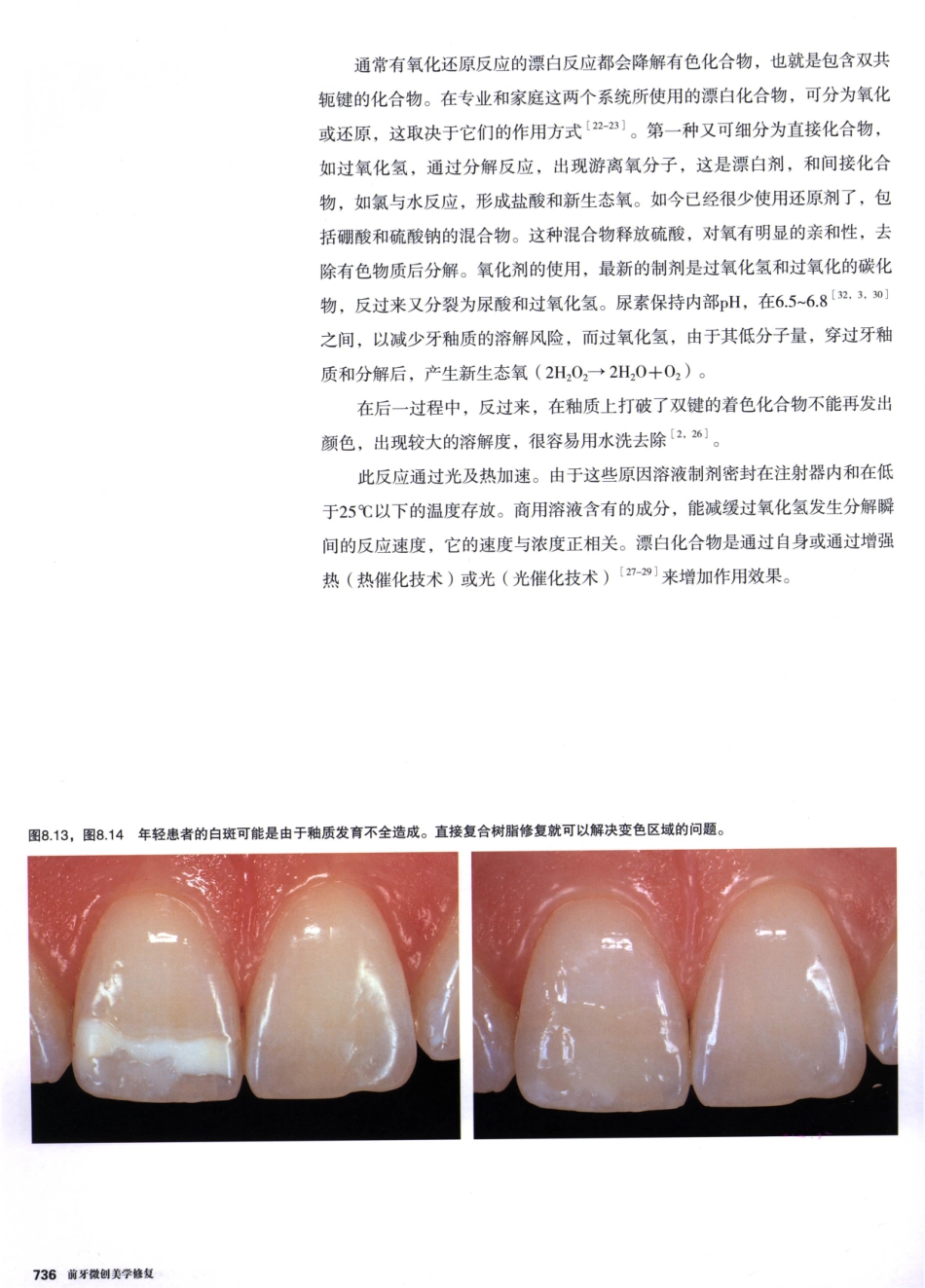 前牙微创美学修复（第2卷）_周锐2015（彩图）书签_331-345.pdf_第2页