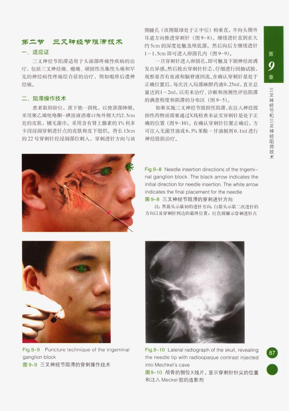 临床局部麻醉技术_101-125.pdf_第2页