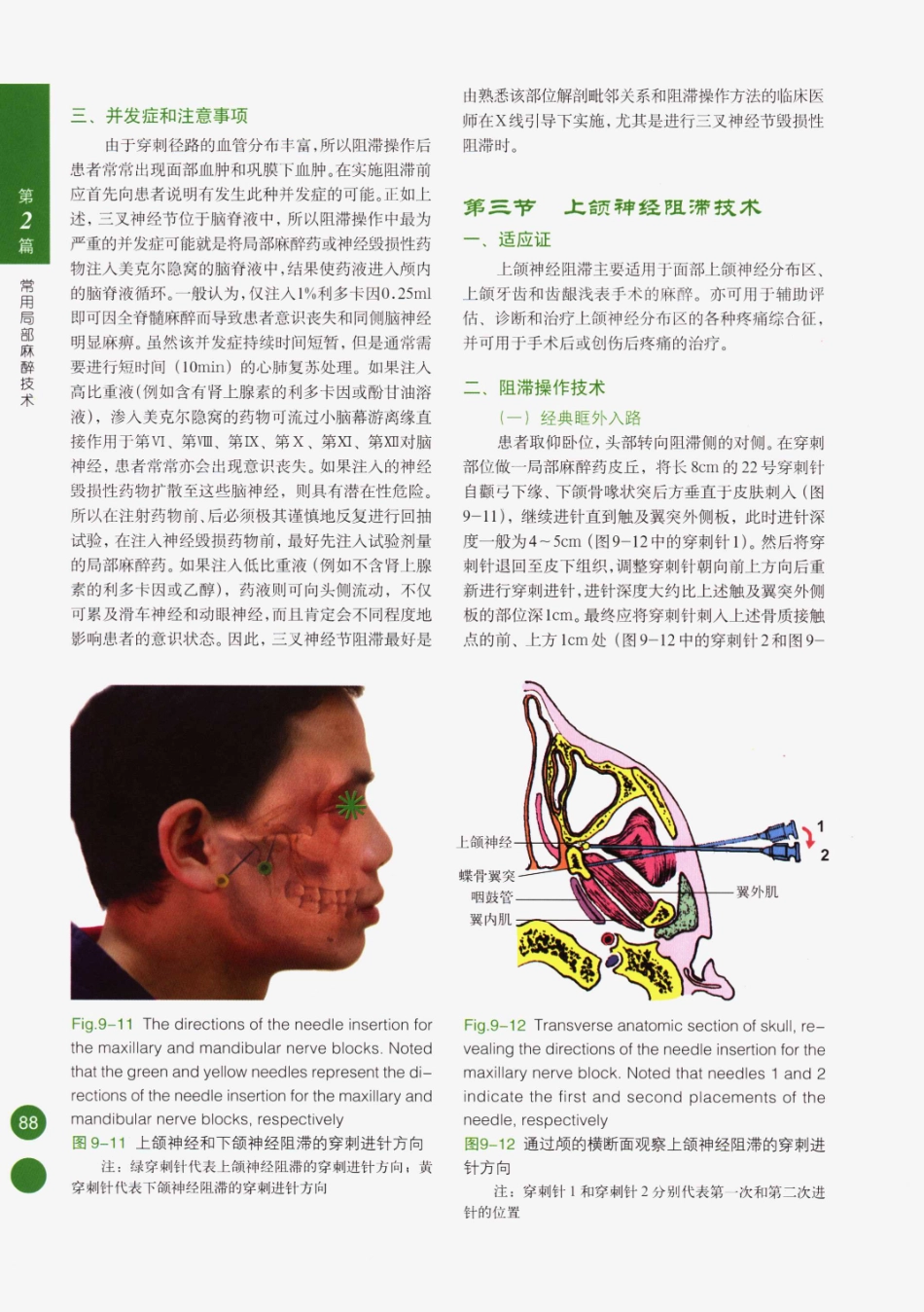 临床局部麻醉技术_101-125.pdf_第3页