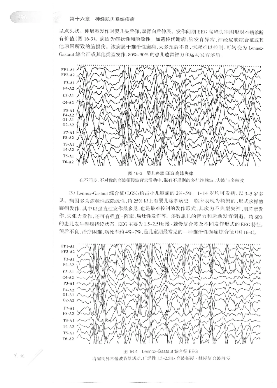 04.儿科学（第8版）_417-432.pdf_第3页
