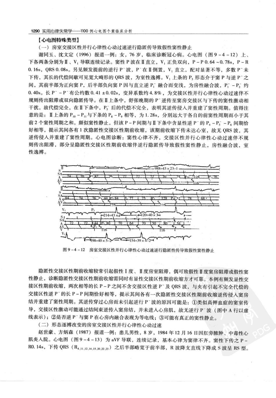 实用心律失常学：1100例心电图个案临床分析  第2版_中国协和医科大学出版社_2008.10_夏宏器，邓开伯主编_1301-1350.pdf_第2页