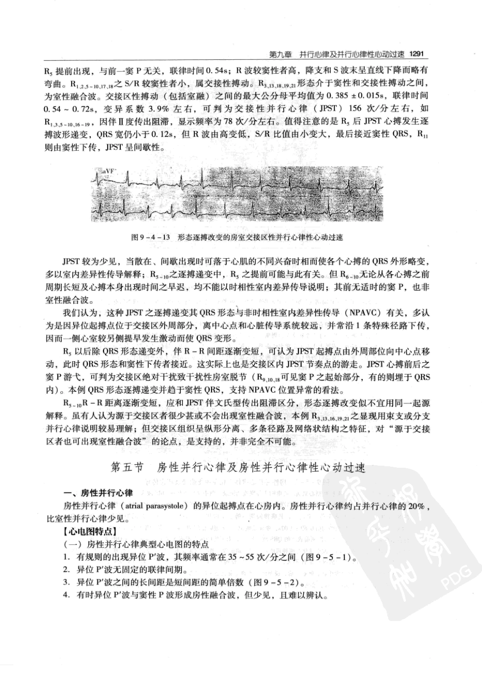 实用心律失常学：1100例心电图个案临床分析  第2版_中国协和医科大学出版社_2008.10_夏宏器，邓开伯主编_1301-1350.pdf_第3页