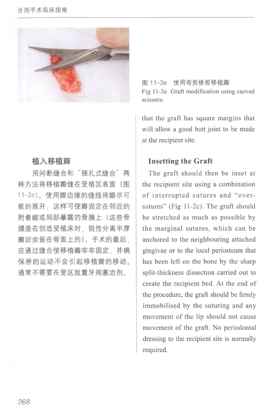 牙周手术临床指南 中英文对照_俞雪芬2013（彩图）_277-288.pdf_第2页