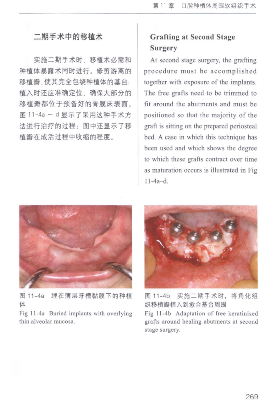 牙周手术临床指南 中英文对照_俞雪芬2013（彩图）_277-288.pdf_第3页