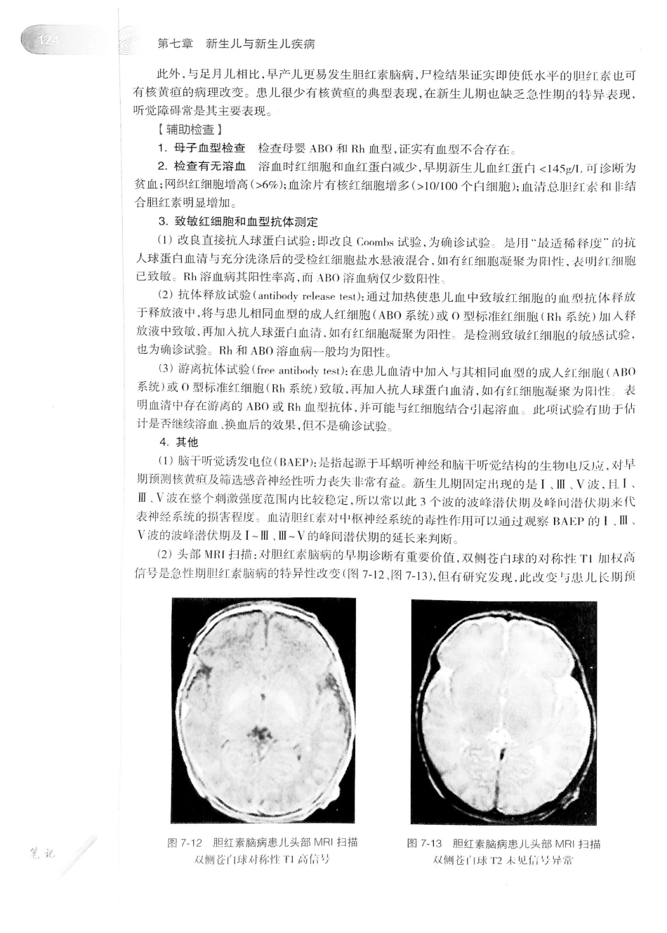 04.儿科学（第8版）_145-160.pdf_第3页