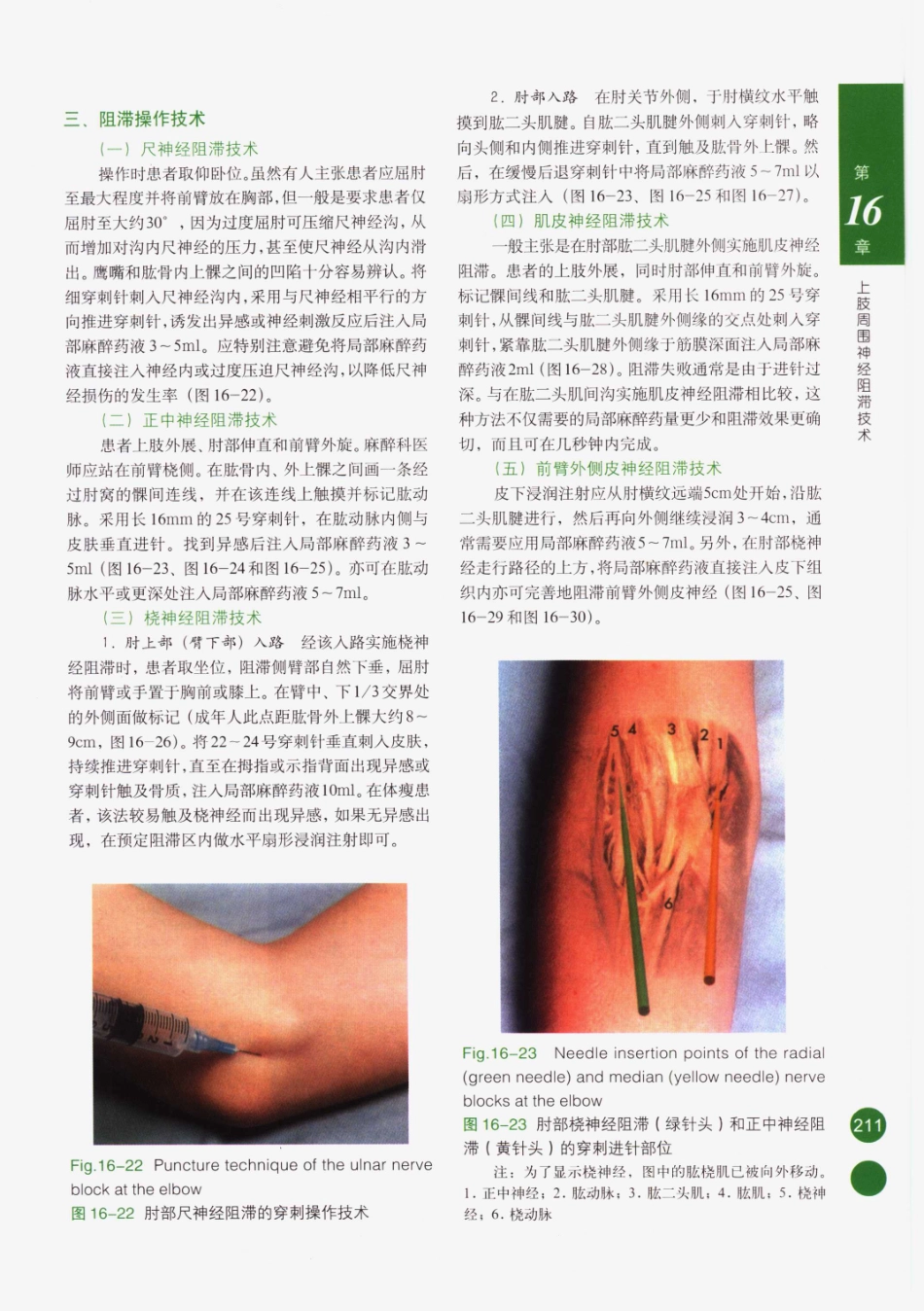 临床局部麻醉技术_226-250.pdf_第1页